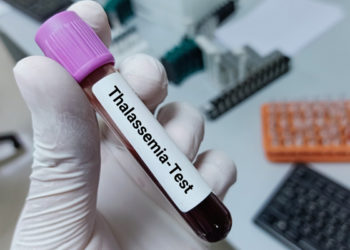 شادی اور تھلیسیمیا ٹیسٹ لازم و ملزوم کیوں؟